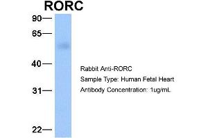 Host: Rabbit Target Name: RORC Sample Type: Human Fetal Heart Antibody Dilution: 1.