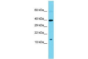 Western Blotting (WB) image for anti-Sperm Associated Antigen 11B (SPAG11B) (N-Term) antibody (ABIN2774058) (SPAG11B anticorps  (N-Term))