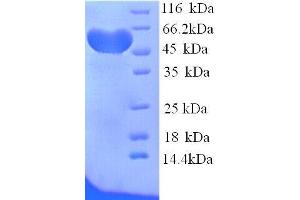 Hemopexin (HPX) (AA 24-460), (full length) protein (His tag)