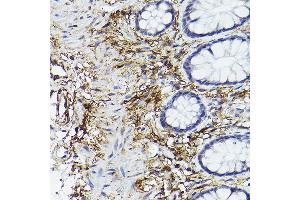Immunohistochemistry of paraffin-embedded human colon using CD90/Thy1 Rabbit mAb (ABIN6129735, ABIN6148554, ABIN6148555 and ABIN7101405) at dilution of 1:100 (40x lens). (CD90 anticorps)