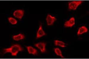 ABIN6278605 staining Hela by IF/ICC. (OR2A5/2A14 anticorps)