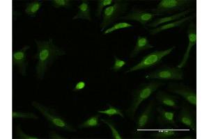 Immunofluorescence of monoclonal antibody to ZIC3 on HeLa cell. (ZIC3 anticorps  (AA 182-274))