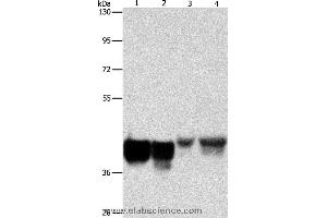Western blot analysis of Hela and 293T cell, mouse liver tissue and NIH/3T3 cell, using AUP1 Polyclonal Antibody at dilution of 1:500 (Ancient Ubiquitous Protein 1 anticorps)