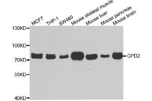 Western blot analysis of extracts of various cell lines, using GPD2 antibody. (GPD2 anticorps  (AA 25-325))