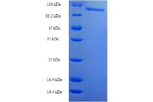 SDS-PAGE (SDS) image for Ribonucleotide Reductase M1 (RRM1) (AA 1-761), (full length) protein (His-SUMO Tag) (ABIN5710974)