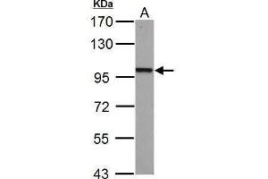 Western Blotting (WB) image for anti-Catenin (Cadherin-Associated Protein), beta 1, 88kDa (CTNNB1) (N-Term) antibody (ABIN2855042)