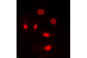 Immunofluorescent analysis of TRA2A staining in HeLa cells. (TRA2A anticorps  (C-Term))