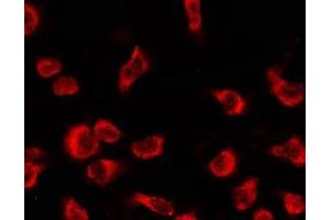 ABIN6278609 staining Hela by IF/ICC. (OR4C12 anticorps  (Internal Region))
