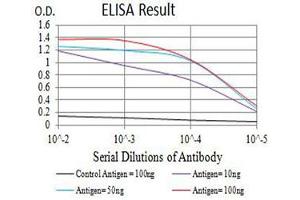 Black line: Control Antigen (100 ng),Purple line: Antigen (10 ng), Blue line: Antigen (50 ng), Red line:Antigen (100 ng)