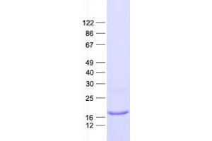 Validation with Western Blot