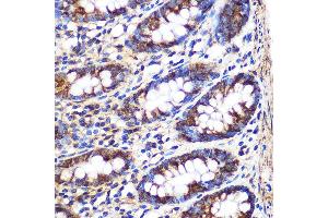 Immunohistochemistry of paraffin-embedded Human colon using FGF2 Rabbit pAb (ABIN3020744, ABIN3020745, ABIN3020746 and ABIN6213702) at dilution of 1:100 (40x lens). (FGF2 anticorps  (AA 143-288))