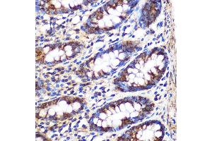 Immunohistochemistry of paraffin-embedded Human colon using FGF2 Rabbit pAb (ABIN3020744, ABIN3020745, ABIN3020746 and ABIN6213702) at dilution of 1:100 (40x lens).