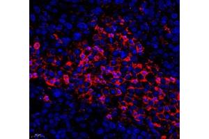 Immunofluorescence of paraffin embedded human ovarian cancer using KCTD19 (ABIN7075147) at dilution of 1: 500 (400x lens) (KCTD19 anticorps)