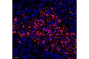 Immunofluorescence of paraffin embedded human ovarian cancer using KCTD19 (ABIN7075147) at dilution of 1: 500 (400x lens) (KCTD19 anticorps)