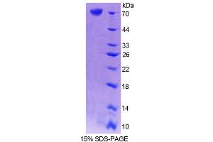 SDS-PAGE analysis of Mouse CRTAP Protein. (CRTAP Protéine)