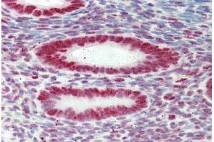 Human Uterus: Formalin-Fixed, Paraffin-Embedded (FFPE) (HNRNPAB anticorps  (AA 1-30))