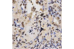 Immunohistochemistry (IHC) image for anti-Histone H3 (H3) (H3K36me2) antibody (ABIN3016036)