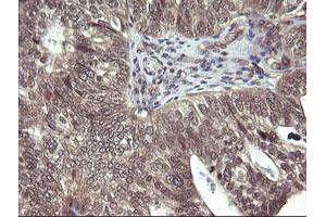 Image no. 1 for anti-Parvin, alpha (PARVA) antibody (ABIN1496442)