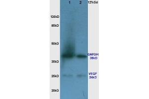 Rat lung lysates probed with Anti VEGF Polyclonal Antibody, Unconjugated (ABIN674829) at 1:200 in 4 °C. (VEGF anticorps)