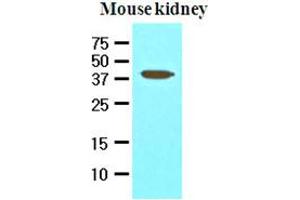 Western Blotting (WB) image for anti-Apoptosis, Caspase Activation Inhibitor (AVEN) (AA 254-362) antibody (ABIN336089) (AVEN anticorps  (AA 254-362))