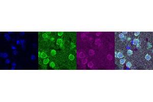 Immunohistochemistry (IHC) image for anti-Oligodendrocyte Lineage Transcription Factor 2 (OLIG2) antibody (ABIN7456034)