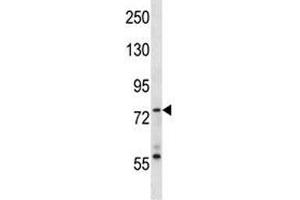 Syk antibody western blot analysis in MDA-MB453 lysate.