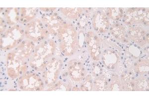 Detection of FLII in Human Kidney Tissue using Polyclonal Antibody to Flightless I Homolog (FLII)