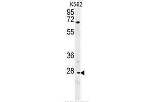 CXCR3 Antibody (Center) western blot analysis in K562 cell line lysates (35µg/lane). (CXCR3 anticorps  (Middle Region))