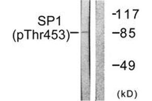 Western blot analysis of extracts from A549 cells, using SP1 (Phospho-Thr453) Antibody.