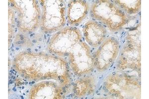 ABIN6260882 and ABIN6279306 at 1/100 staining human normal kidney tissue by IHC-P.