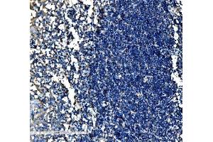 IHC analysis of SCF/KITLG using anti-SCF/KITLG antibody (ABIN5519022).