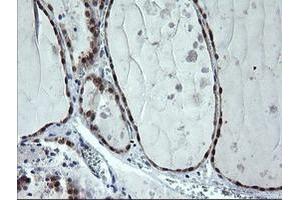 Image no. 2 for anti-Cytidine Monophosphate (UMP-CMP) Kinase 1, Cytosolic (CMPK1) antibody (ABIN1497542)