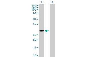 Lane 1: PCSK1N transfected lysate ( 27. (PCSK1N 293T Cell Transient Overexpression Lysate(Denatured))