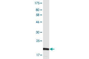 Western Blot detection against Immunogen (20.
