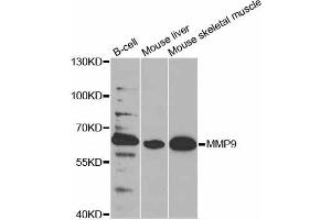 Western blot analysis of extracts of various cell lines, using MMP9 antibody. (MMP 9 anticorps)