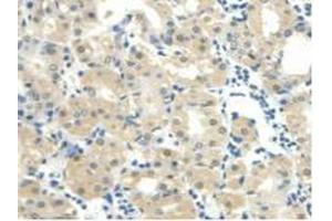 IHC-P analysis of Human Stomach Tissue, with DAB staining. (CALML3 anticorps  (AA 1-149))