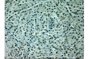 Immunohistochemical staining of paraffin-embedded Kidney tissue using anti-NEUROG1mouse monoclonal antibody. (Neurogenin 1 anticorps)