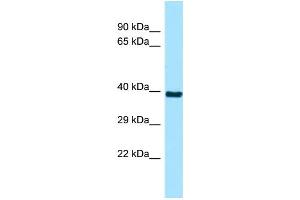 WB Suggested Anti-RSPH9 Antibody Titration: 1.