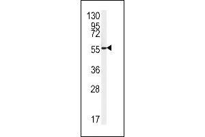 Western blot analysis of FH2 Antibody (C-term) (ABIN651343 and ABIN2840194) in HepG2 cell line lysates (35 μg/lane). (FAAH2 anticorps  (C-Term))