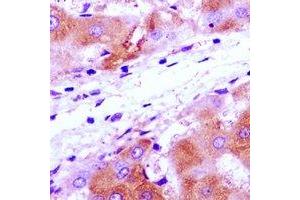 Immunohistochemistry (IHC) image for anti-Ribosomal Protein S7 (RPS7) antibody (ABIN7308296)