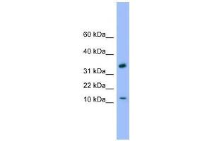 GABARAP antibody used at 0. (GABARAP anticorps  (C-Term))