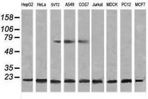 Image no. 6 for anti-NADH Dehydrogenase (Ubiquinone) 1 beta Subcomplex, 10, 22kDa (NDUFB10) antibody (ABIN1499669)