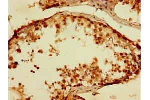 Immunohistochemistry of paraffin-embedded human testis tissue using ABIN7173606 at dilution of 1:100 (TPSB2 anticorps  (AA 31-275))