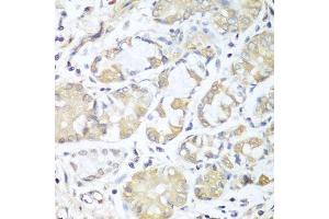 Immunohistochemistry of paraffin-embedded human stomach using RPH3AL antibody.