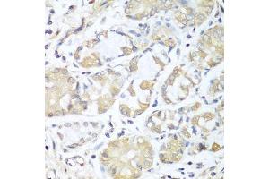 Immunohistochemistry of paraffin-embedded human stomach using RPH3AL antibody. (RPH3AL anticorps  (AA 161-315))