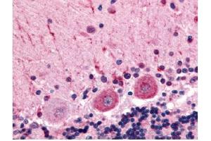 Immunohistochemical staining of human brain (Purkinje Neurons) using anti-CELSR3 antibody (CELSR3 anticorps  (C-Term))