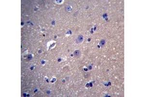 Immunohistochemistry analysis in human brain tissue (Formalin-fixed, Paraffin-embedded) using DNAJB6  Antibody , followed by peroxidase conjugated secondary antibody and DAB staining.