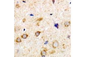Immunohistochemical analysis of Rabphilin 3A staining in human brain formalin fixed paraffin embedded tissue section. (RPH3A anticorps)