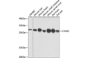 Western blot analysis of extracts of various cell lines using CALB2 Polyclonal Antibody at dilution of 1:1000. (Calretinin anticorps)