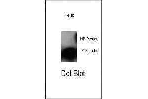 Dot blot analysis of anti-Phospho-cJun-S63 Antibody (ABIN389544 and ABIN2839589) on nitrocellulose membrane. (C-JUN anticorps  (pSer63))